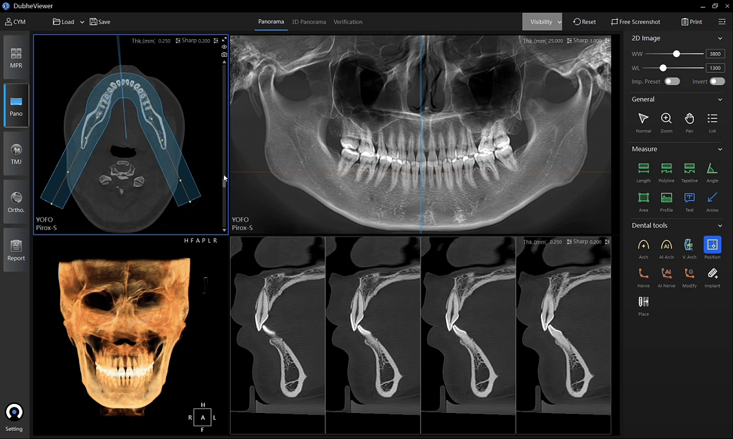 Intelligent panoramic reconstruction interface